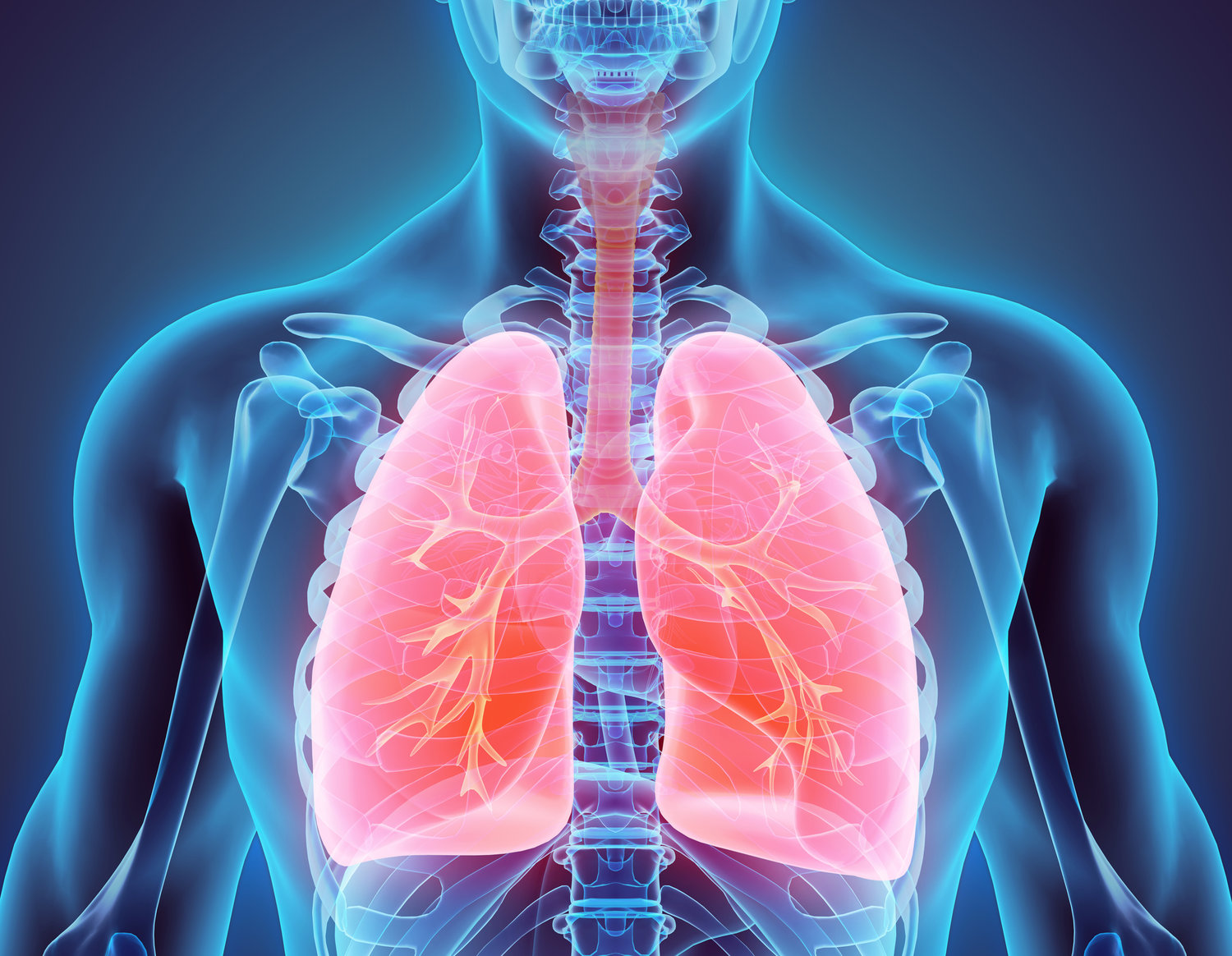 No Brasil, 87,9% dos casos de câncer de pulmão são diagnosticados quando não há mais possibilidade cirúrgica