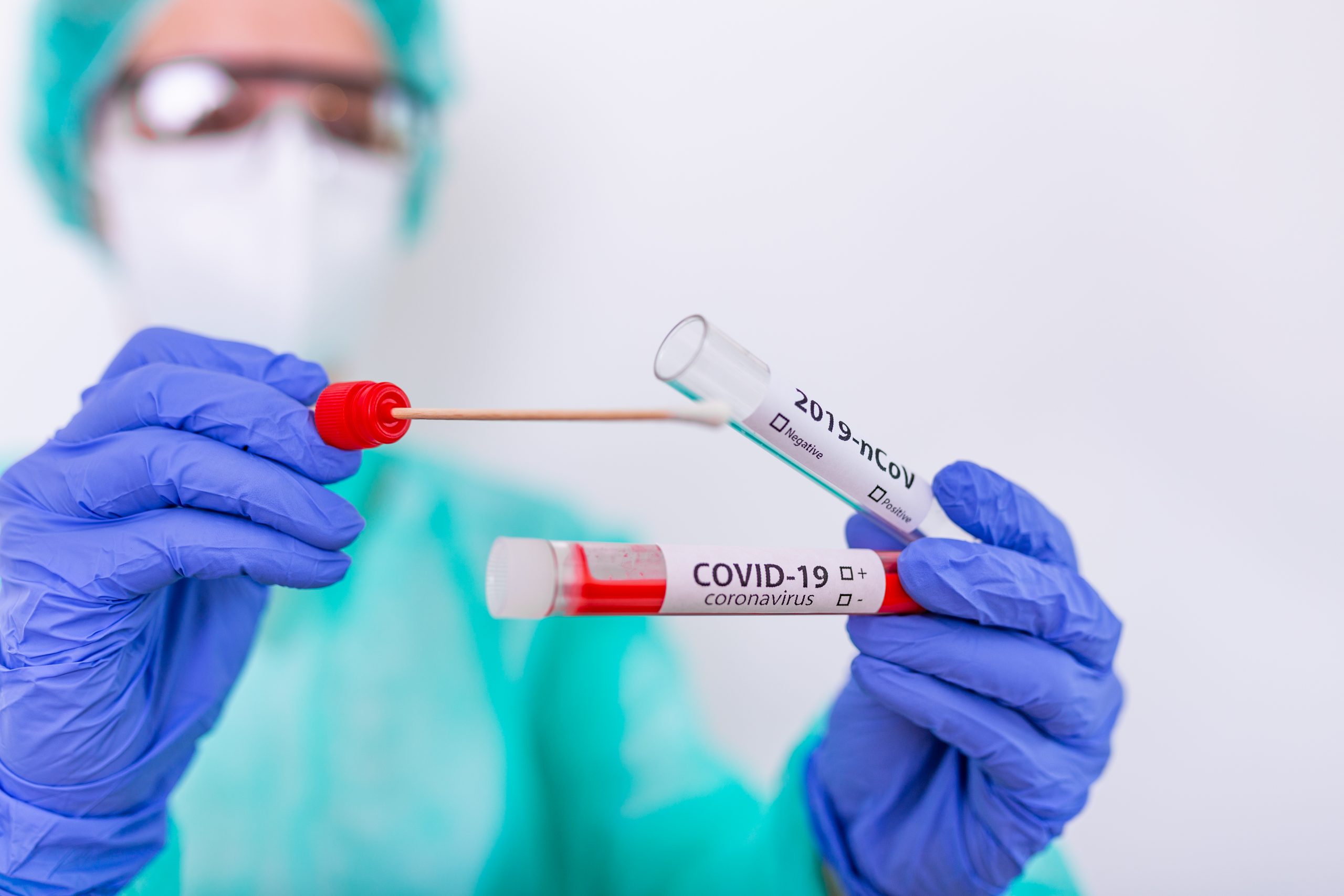 Laboratórios privados fizeram 3 milhões de testes de COVID-19 no primeiro bimestre; média mensal é maior do que a de 2020