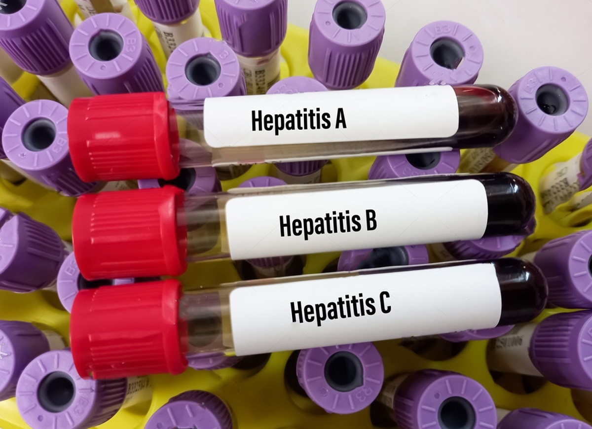Abramed apresenta dados sobre hepatites virais