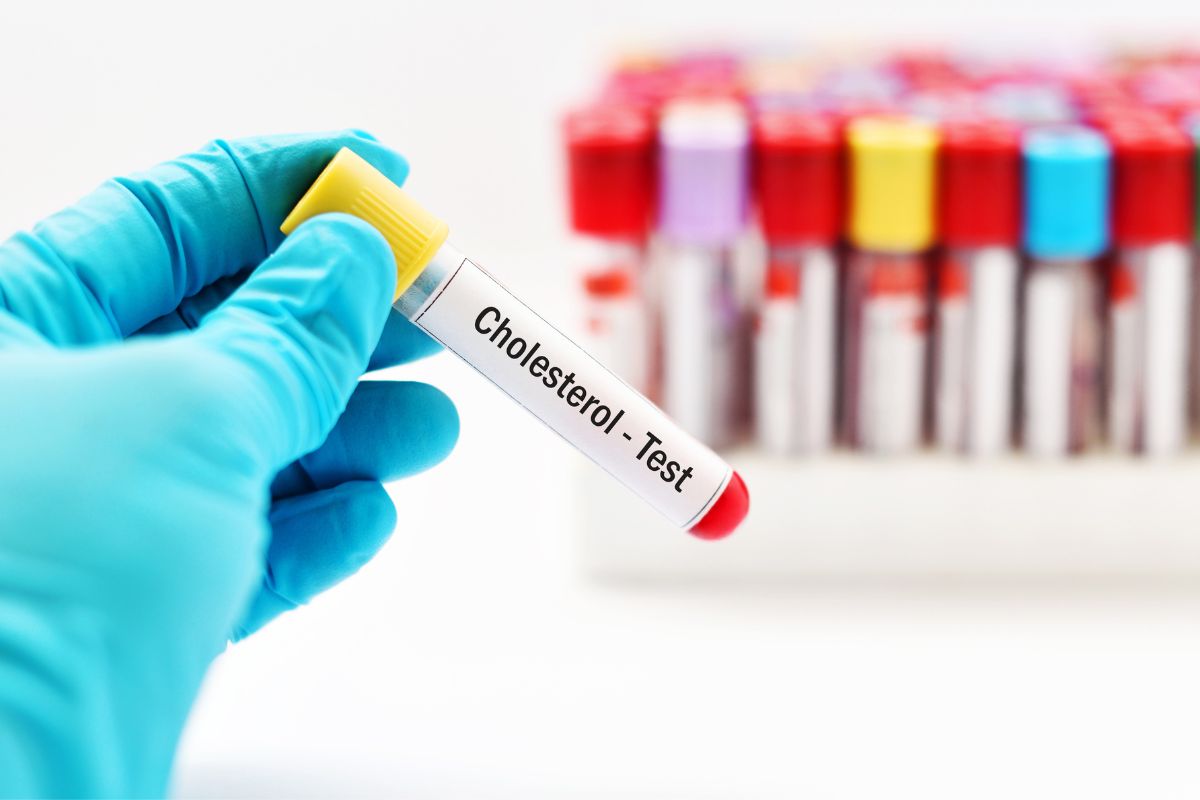 Número de exames de colesterol realizados na rede privada cresce 7,2%, segundo Abramed