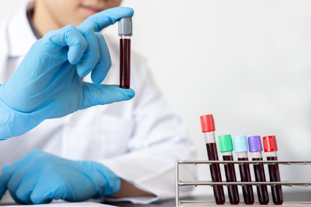 Abramed destaca a importância de nova lista de exames para diagnósticos essenciais publicada pela OMS