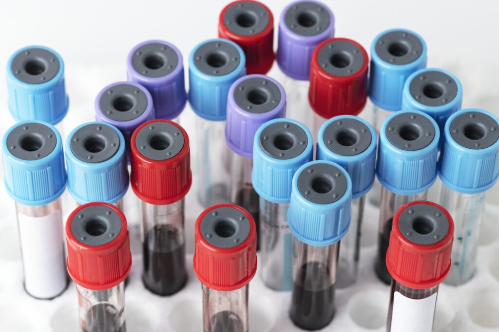 Com colaboração estratégica da Abramed, Política Nacional do Diagnóstico Laboratorial avança e une entidades do setor