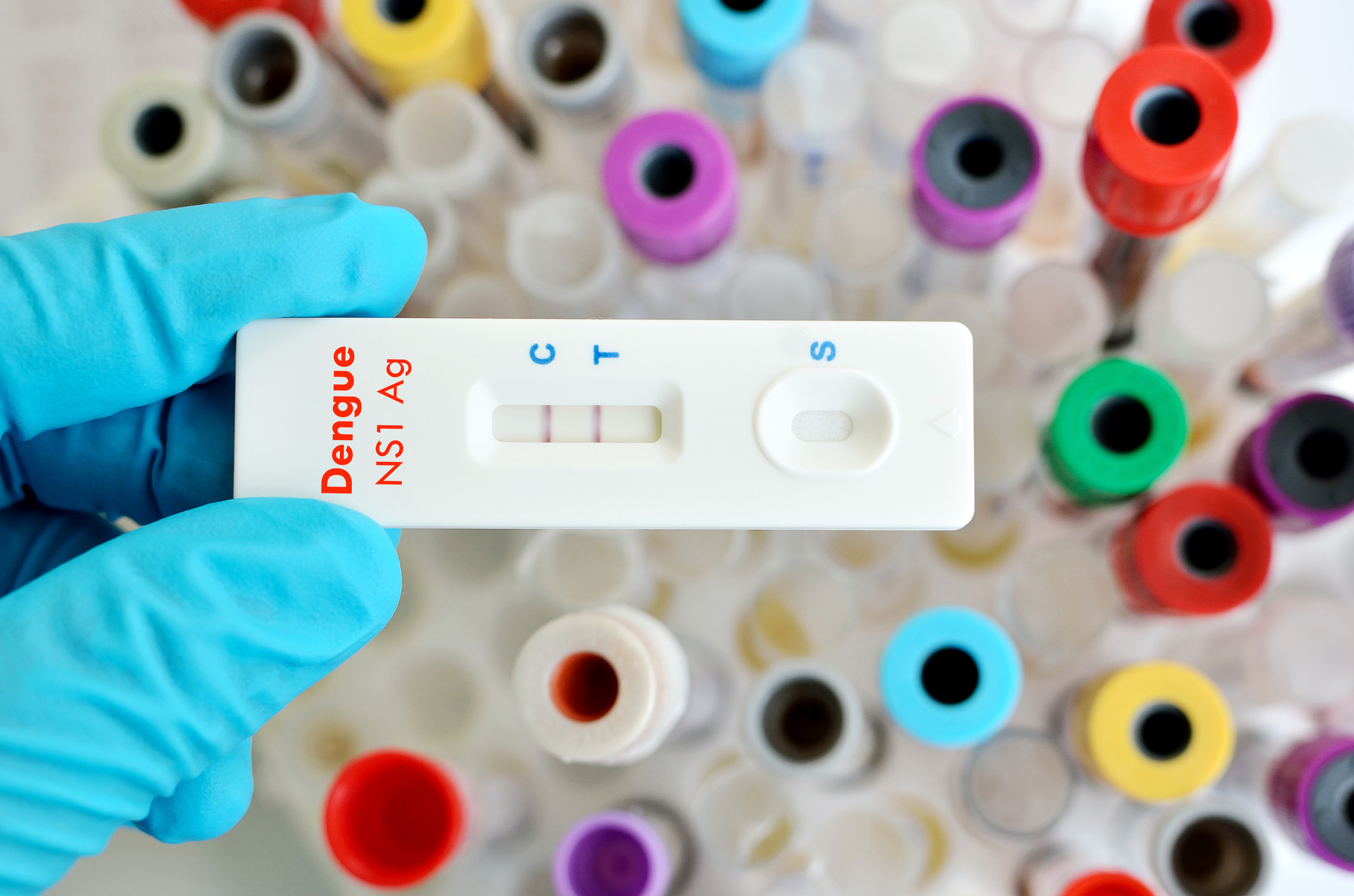 Alta de positividade para dengue no brasil bate recorde desde maio de 2024, aponta Abramed